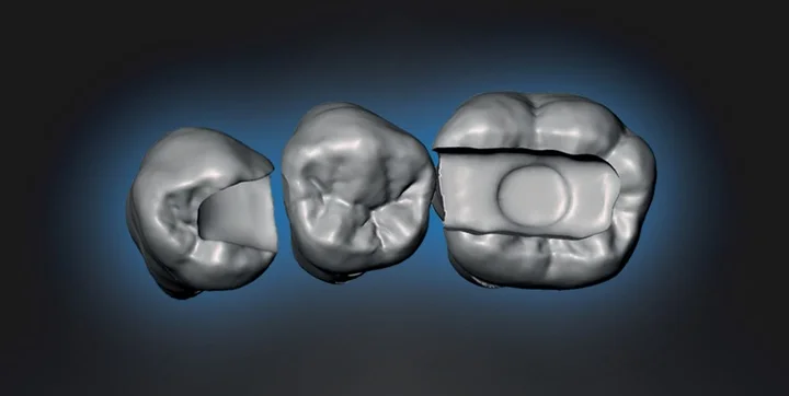 Grafika promocyjna wydarzenia Nowy termin: Szkolenie teoretyczno‑praktyczne — Odbudowy w odcinku bocznym